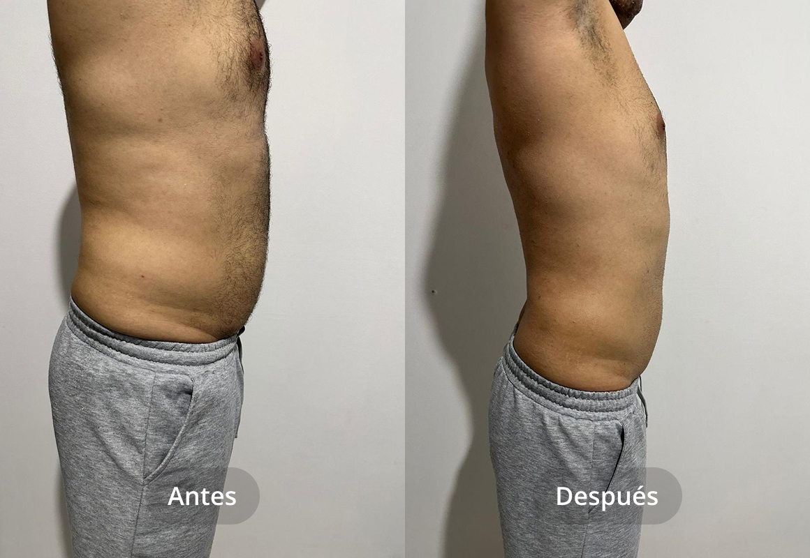 Estética Coporal
