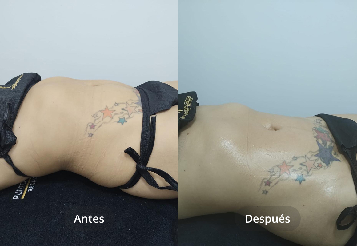 Estética Coporal