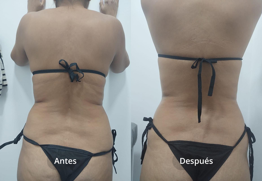 Estética Coporal
